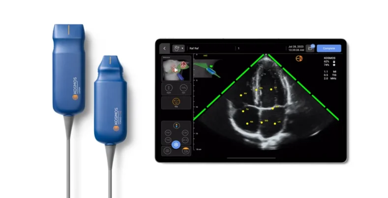 EchoNous Announces Revolutionary AI Enhancements in Upcoming Kosmos Release for Apple iOS